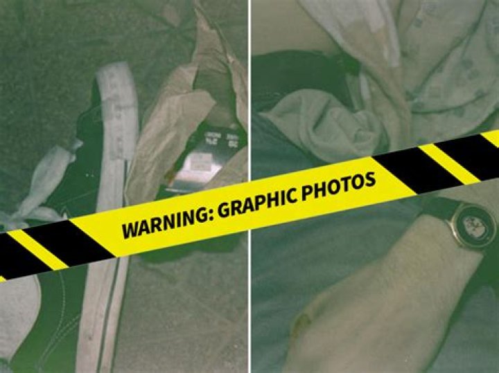 Kagney Linn Karter's Cause Of Death Unravelled