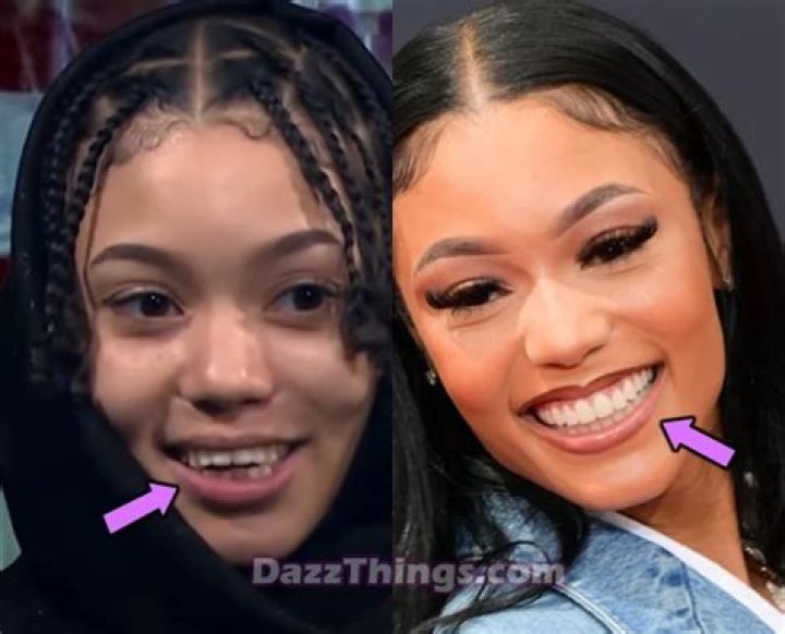 Unlock The Truth About Coi Leray Surgery: Uncover Hidden Discoveries